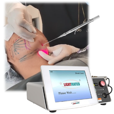 Sculptra BBL Buttock Filler Laser 980nm Lipo 1470nm Endolifting Lipolysis Lemon Bottle Fat Dissolve Injections